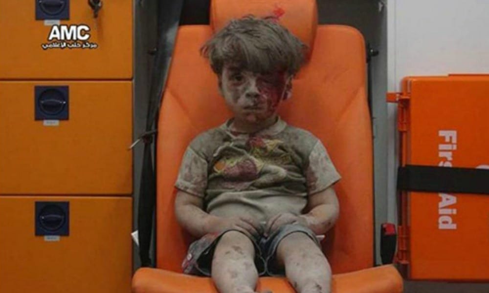 Il bambino di Aleppo salvato dalle bombe simbolo dell'orrore della guerra [VIDEO]