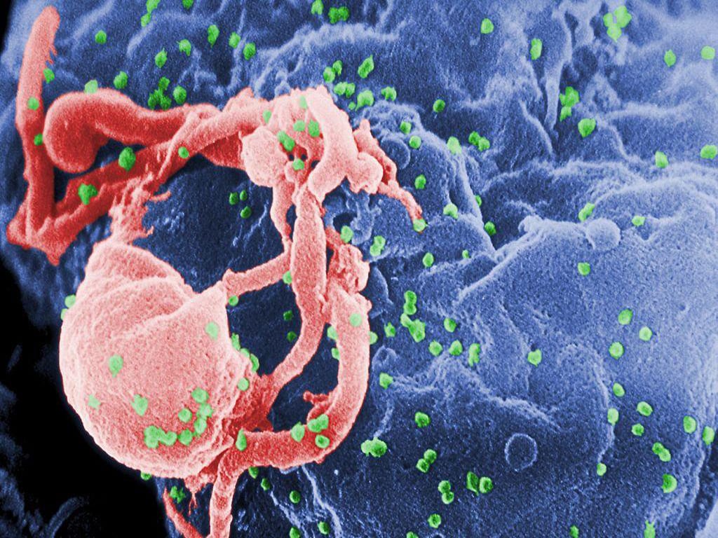 Avrebbe contagiato col virus Hiv decine donne: rinviato a giudizio