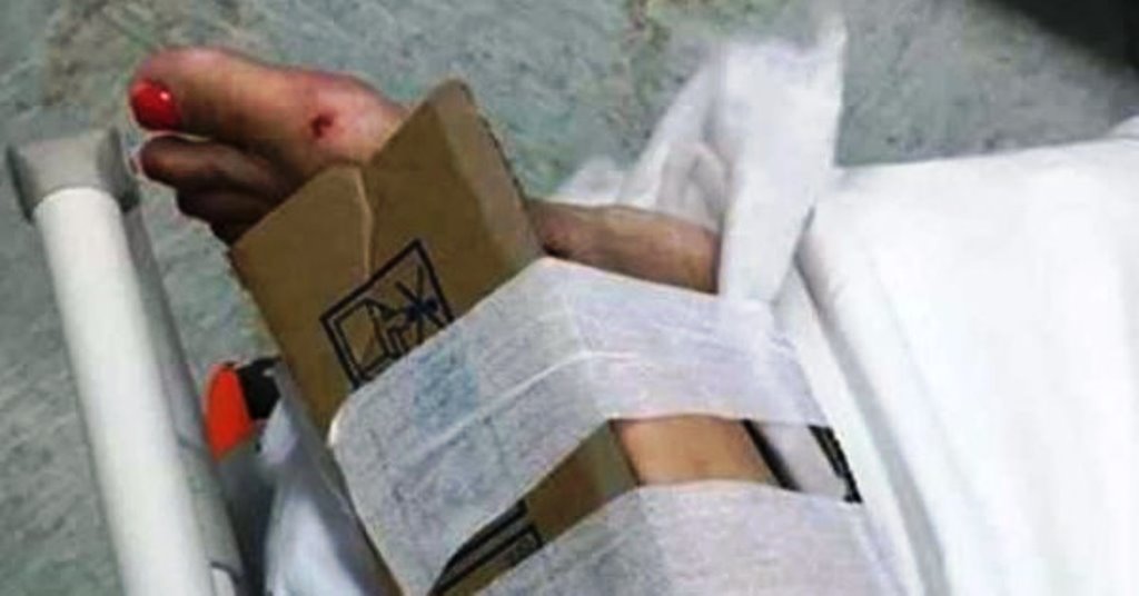 Foto shock dalla Calabria: "Cartone al posto dei gessi in ospedale" [LE IMMAGINI]